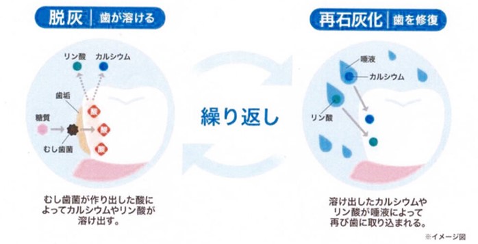 脱灰と脱灰との説明図